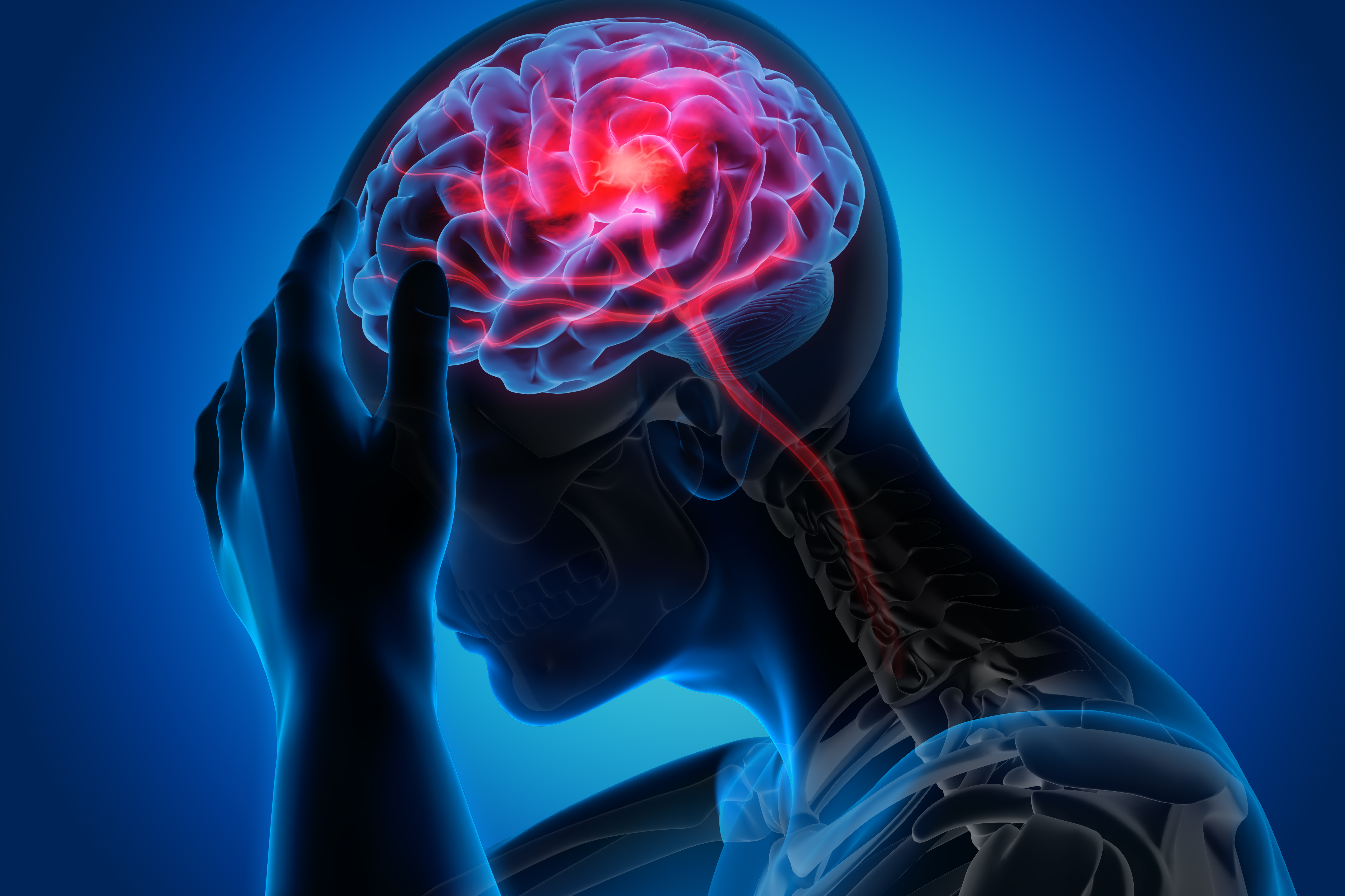 Person having a stroke holding his head